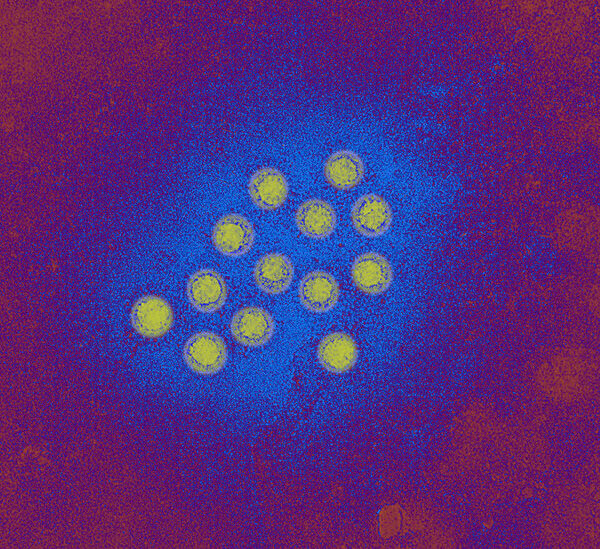 What to know about the hepatitis with outbreaks in the county of Los Angeles