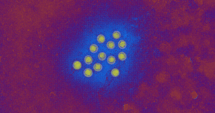 What to know about the hepatitis with outbreaks in the county of Los Angeles