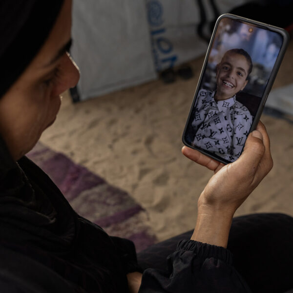 A Gazan Girl’s Battle Against Severe Hunger